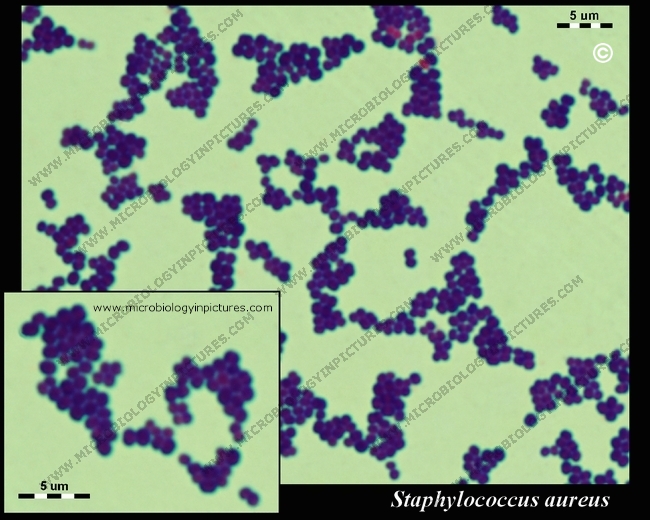 Staphylococcus aureus Gram